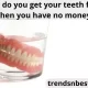 How do you get your teeth fixed when you have no money