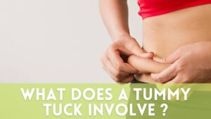What does a tummy tuck involve