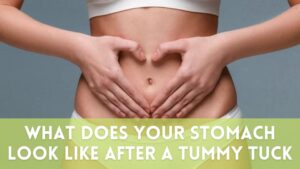 what does your stomach look like after a tummy tuck